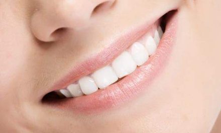 Ortodoncia Lingual: una sonrisa sin sacrificios estéticos