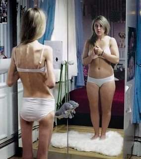 Anorexia y Bulimia: Falsos espejos