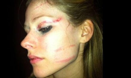 Así quedó el rostro de Avril Lavigne tras pelea en un bar