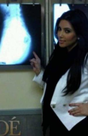 Kim Kardashian comprueba con rayos X autenticidad de su gran trasero