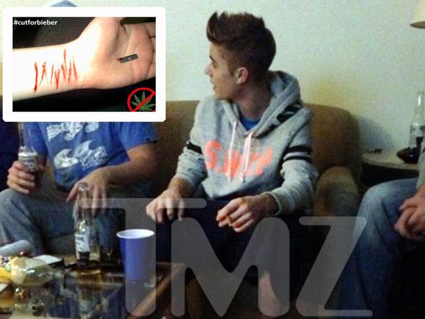 Fans de Justin Bieber se cortan para que él deje las drogas