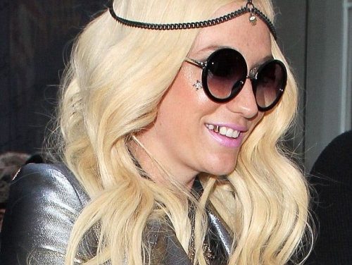 KeSha sorprende con diente de oro en Londres