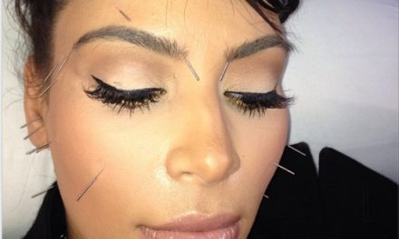 Kim Kardashian elimina el estrés del divorcio con la acupuntura