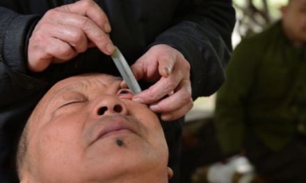 #Insólito: Barbero chino limpia los ojos afeitando el globo ocular
