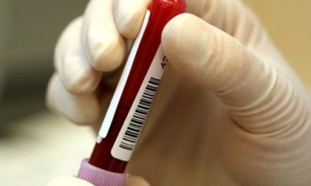 Científicos en Dinamarca afirman que pronto tendrán cura para el SIDA