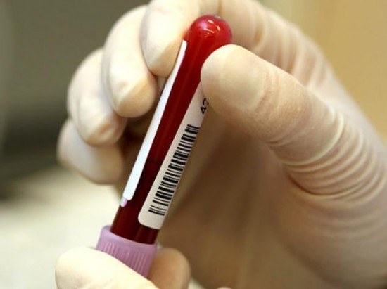 Científicos en Dinamarca afirman que pronto tendrán cura para el SIDA