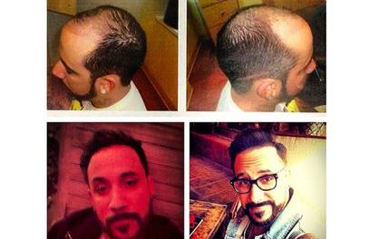 A.J. McLean, de Backstreet Boys, se implanta cabello (+Foto)