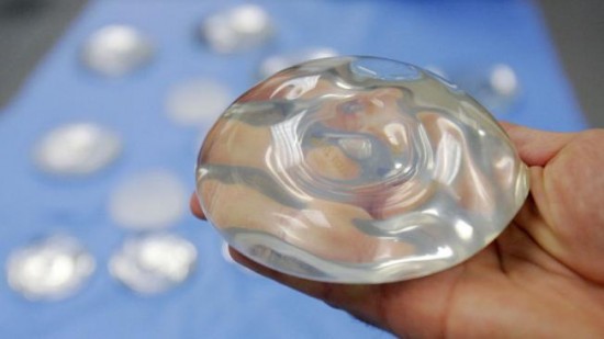 Implante mamario de una joven explota por su mala postura