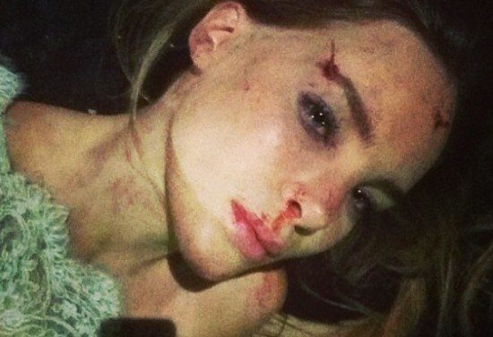 Belinda se disculpó por publicar polémica foto de supuesto accidente