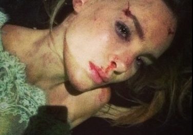 Belinda sufre un accidente y publica la imagen en Instagram (+Foto)
