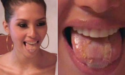 Ex Miss Venezolana Wi May Nava, se cosió malla en la lengua para no comer (+Foto)
