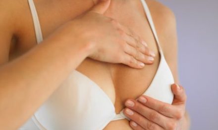 Enfermedad de Paget mamaria: poco frecuente y a menudo mal diagnosticada
