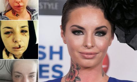 La pornstar Christy Mack (@ChristyMack) se regenera, tras la agresión de su pareja (+Foto)