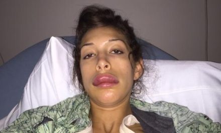 Farrah Abraham (@F1abraham) desfigura su rostro al inyectarse los labios (+Fotos)