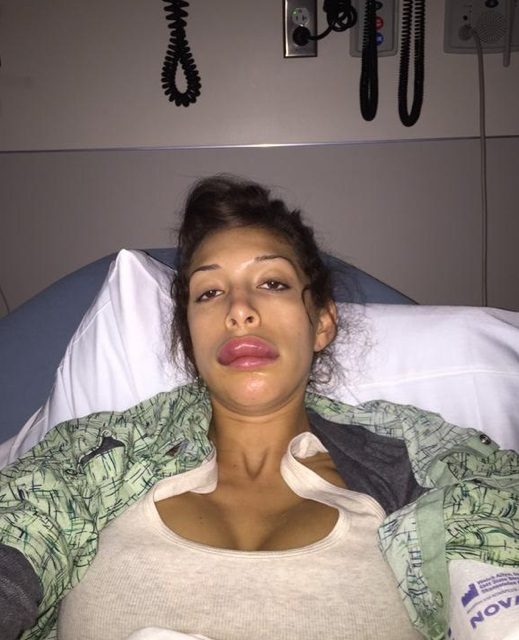 Farrah Abraham (@F1abraham) desfigura su rostro al inyectarse los labios (+Fotos)