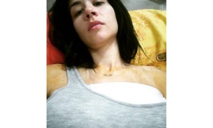 A Diosa Canales(@canalesdiosa) se le revienta un seno practicando pole dance… ya fue operada
