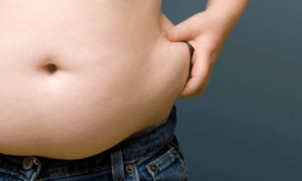 La Obesidad Mórbida tiene una salida: Cirugía Bariátrica y Metabólica
