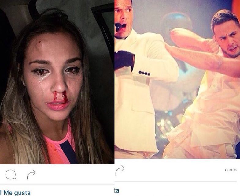 Bailarín de Ricky Martin golpea salvajemente a su expareja: la venezolana Magga Bracoviche