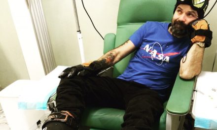 Pau Donés, cantante de Jarabe de Palo, le pone humor a la quimioterapia