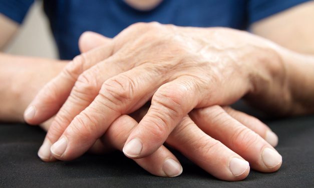 TERAPIAS BUSCAN FRENAR EL DAÑO DE LA ARTRITIS REUMATOIDE