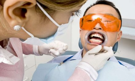 #Enterate: 5 dudas más frecuentes sobre el blanqueamiento dental