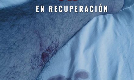 Alejandro Fernández operado por gangrena tras mordida de su perro