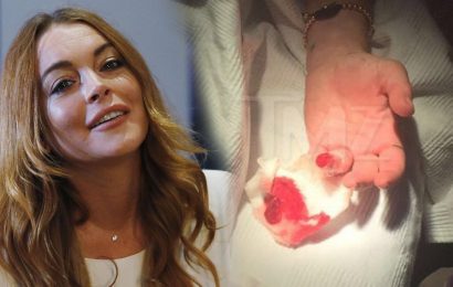 Lindsay Lohan pierde parte de su dedo en un barco