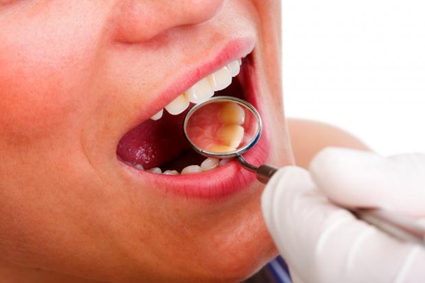 EL VPH SE ASOCIA CADA DÍA MÁS AL CÁNCER BUCAL