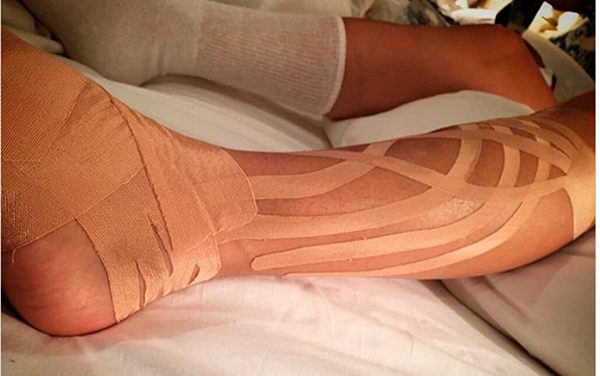 Así quedó la pierna de Paulina Rubio tras su brutal caída (+Foto)