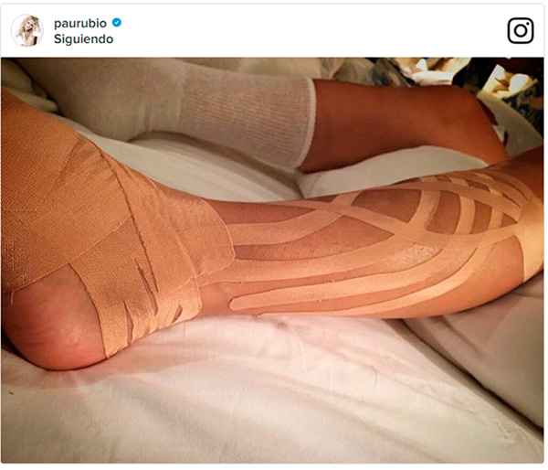 Así quedó la pierna de Paulina Rubio tras su brutal caída (+Foto)